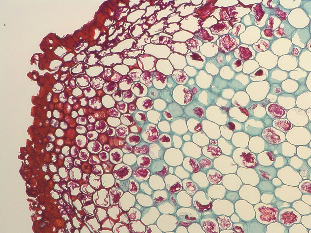 Fern Stem Slides - Fernstem 04 200X